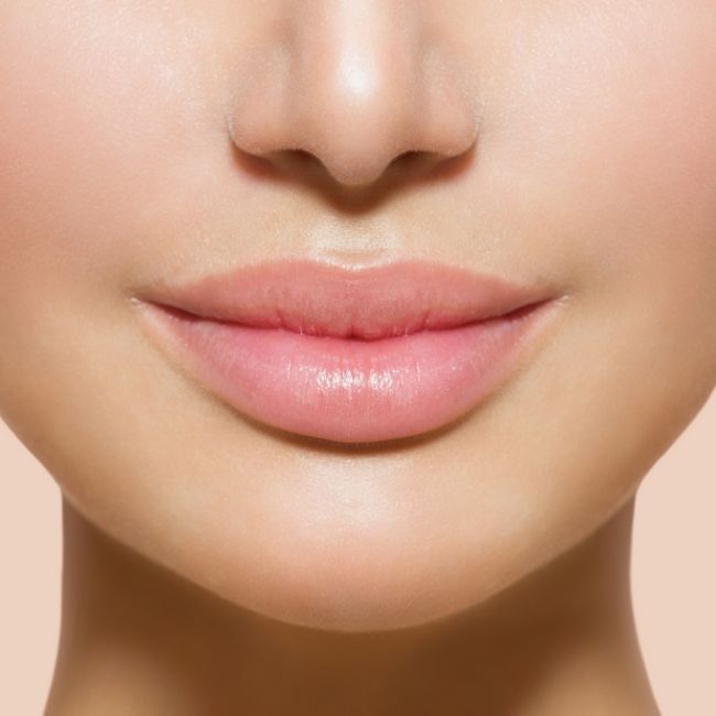 swollen lips after filler