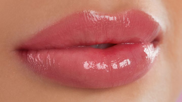 How To Dissolve Lip Filler At Home – What You Should Do