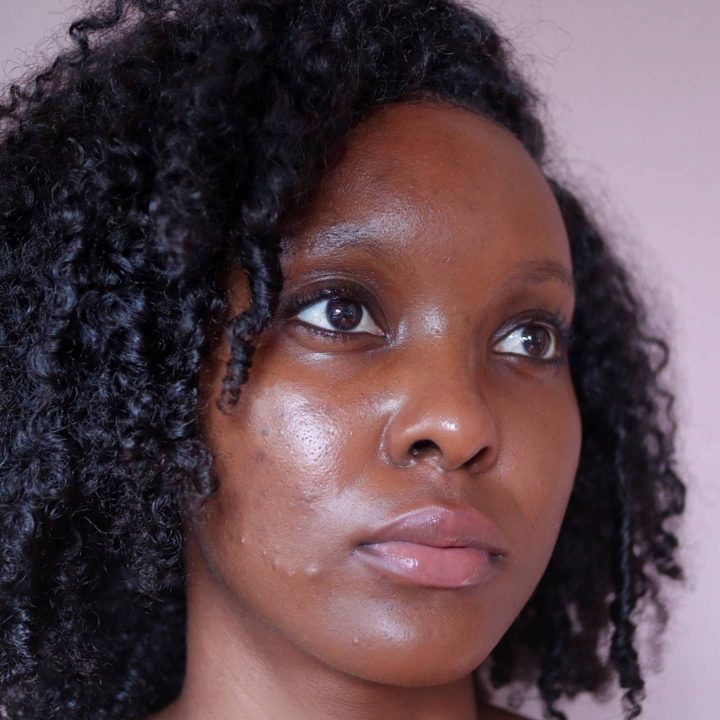 Skincare Routine For Hormonal Acne: A Guide To Clearer, Happier Skin