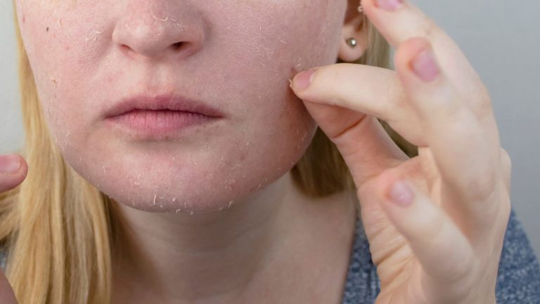 Best Moisturizers For Dry Skin Relief