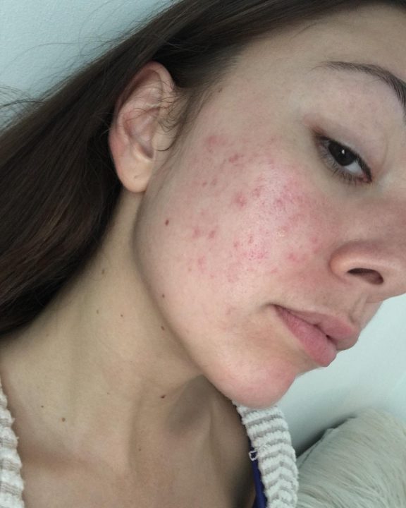 The Essential Skincare Cheat Sheet: Skincare Made Simple!