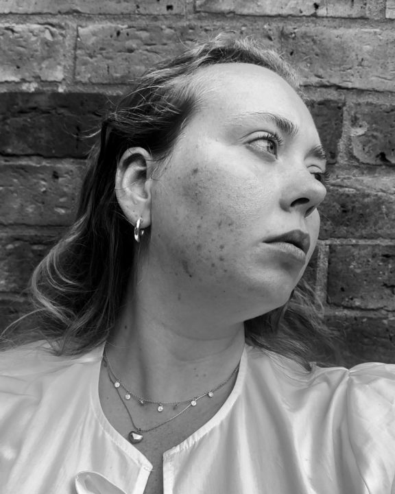 Skincare Routine For Hormonal Acne: A Guide To Clearer, Happier Skin